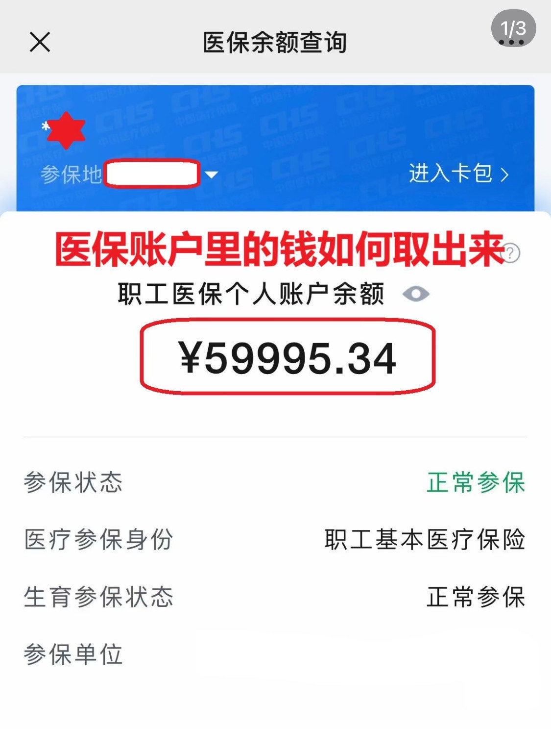 中山为什么医保卡里没有钱(为什么医保卡里没有钱还可以报销)