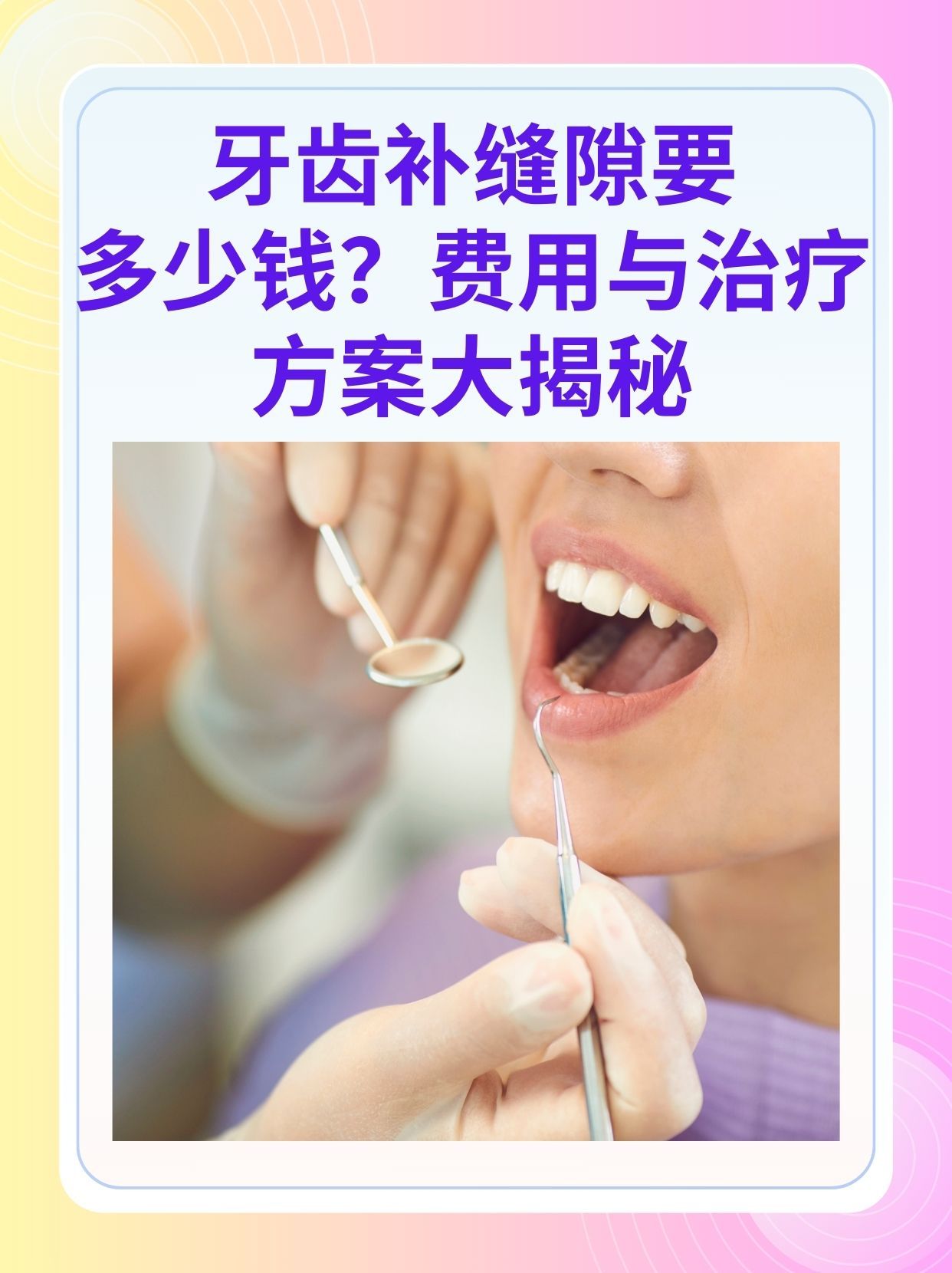 中山补牙医保可以报销吗(补牙医保可以报销吗 哪些可以报销呢)